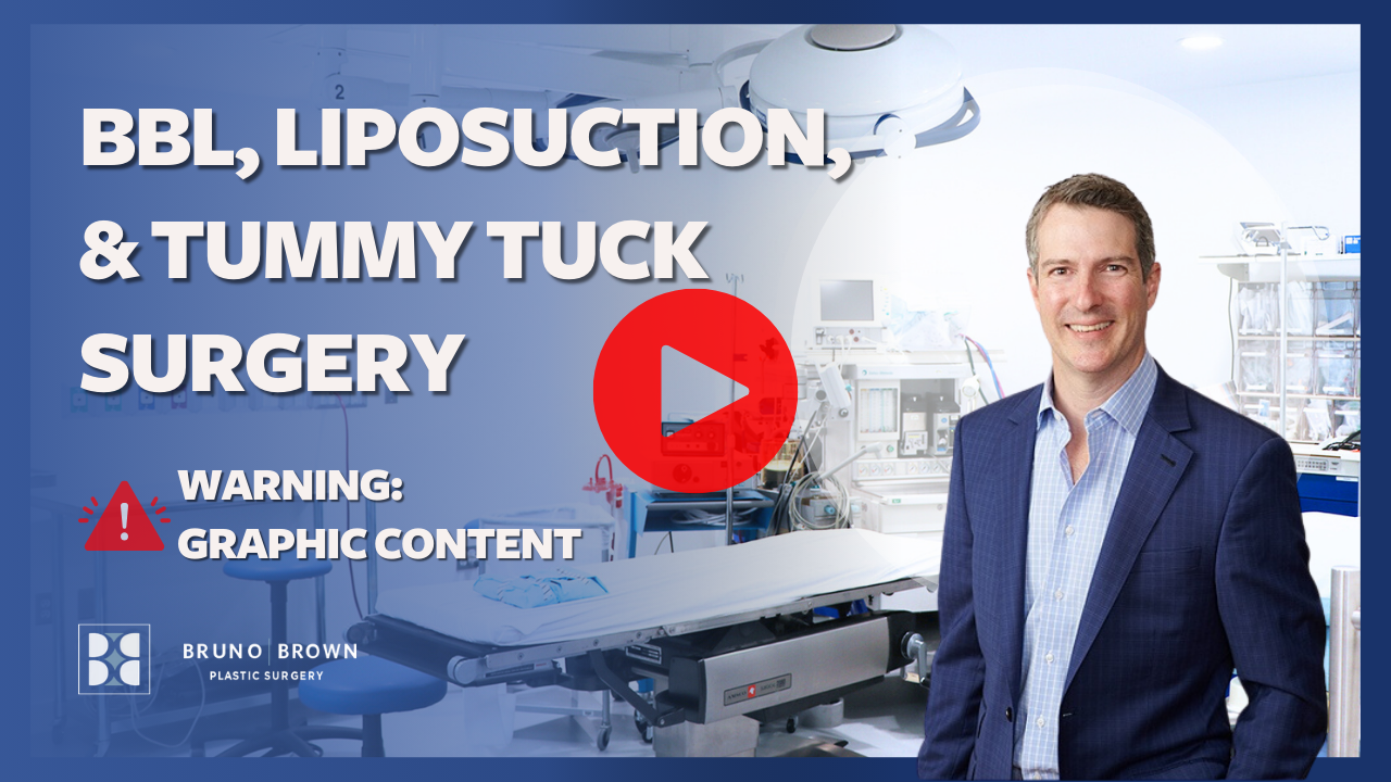 Washington DC Tummy Tuck (Abdominoplasty) Northern Virginia
