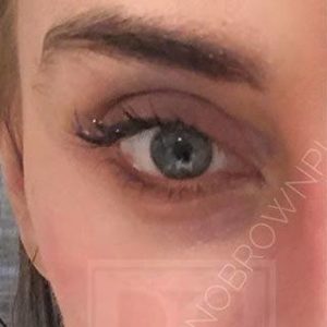 Before and After Filler DC