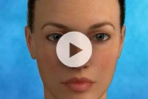 Facelift Procedure Information
