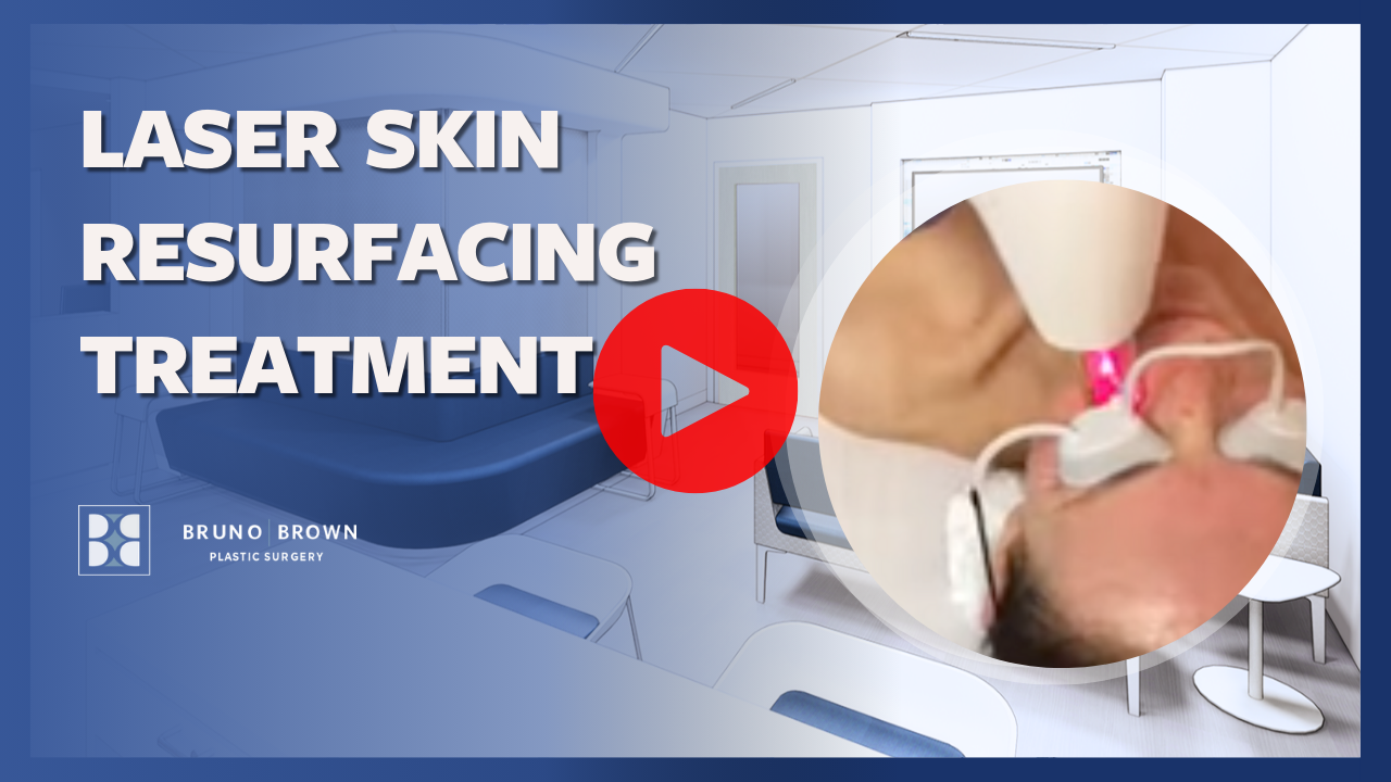 Laser Skin Resurfacing Northern Virginia