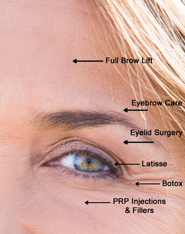 7 steps to younger eyes