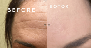 Top DC Plastic Surgeons and Botox