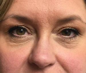 eyesbefore5 (1)