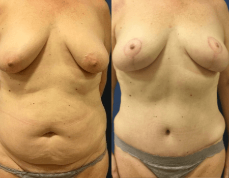 Best Plastic Surgeons in Northern Virginia