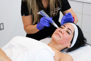 Microneedling with PRP patient at Bruno Brown