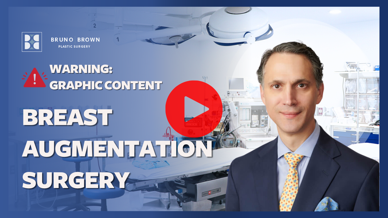 DC Breast Augmentation Northern Virginia