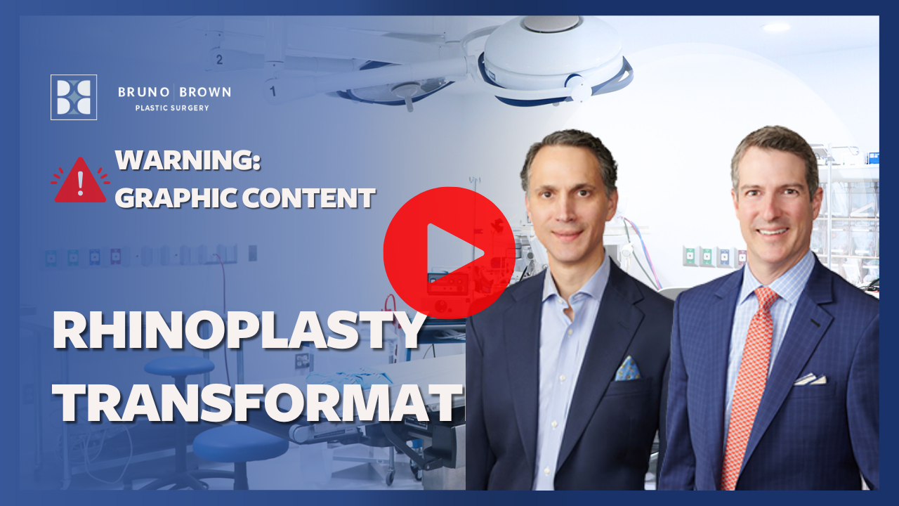 Rhinoplasty Washington DC Northern Virginia